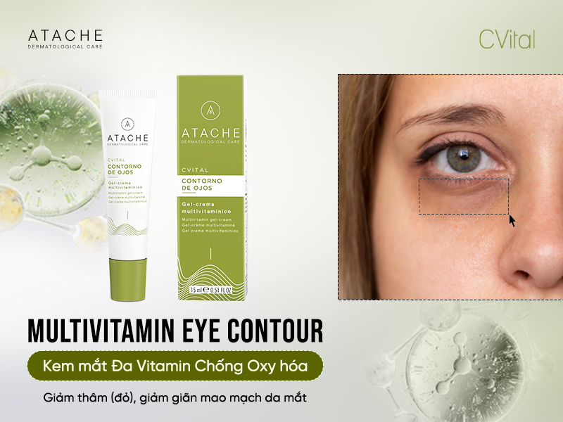 MULTIVITAMIN EYE CONTOUR: KEM MẮT ĐA VITAMIN, GIẢM THÂM, ĐỎ & CẢI THIỆN TÌNH TRẠNG LỘ MAO MẠCH VÙNG MẮT